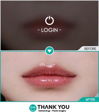Before/After