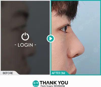 Before/After