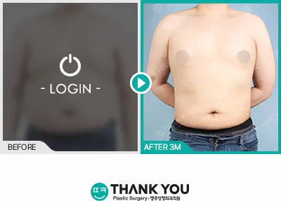 Before/After