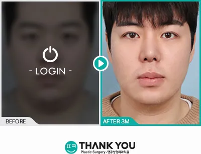 Before/After