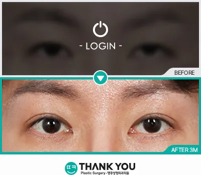 Before/After