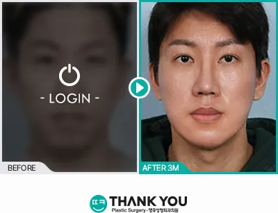 Before/After