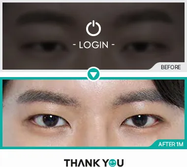 Before/After