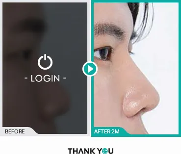 Before/After