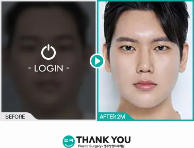 Before/After