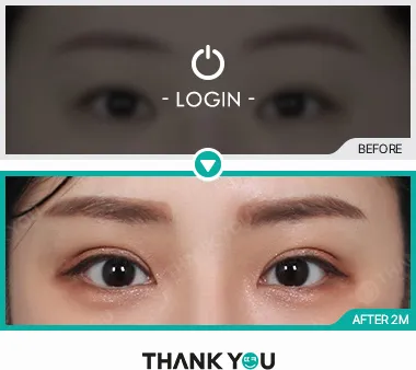 Before/After