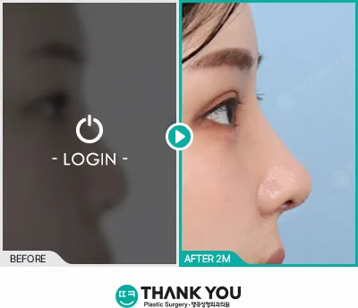 Before/After