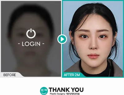 Before/After