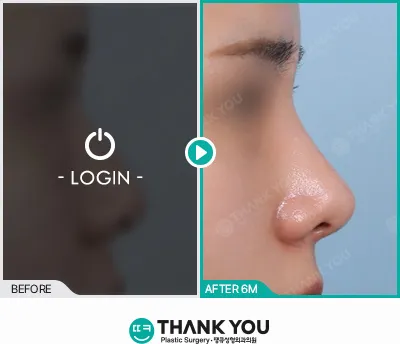 Before/After
