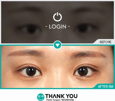 Before/After
