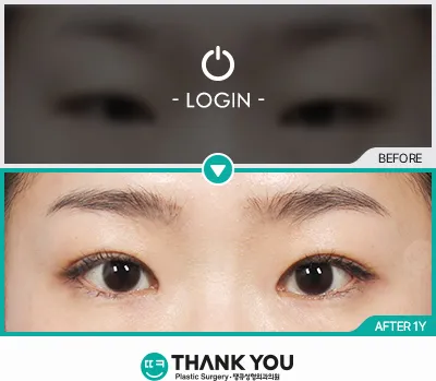Before/After