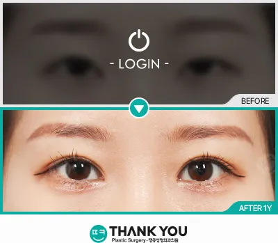 Before/After