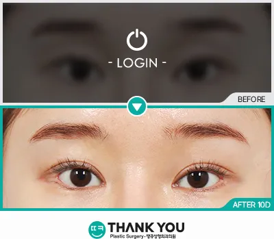 Before/After