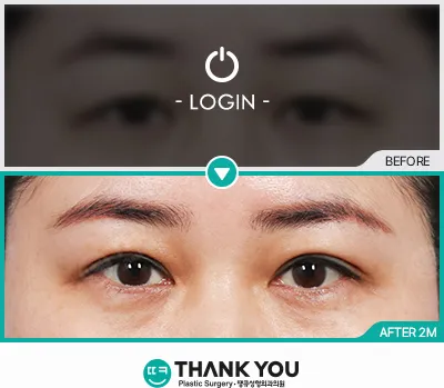 Before/After