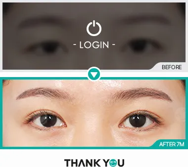 Before/After