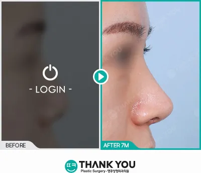 Before/After