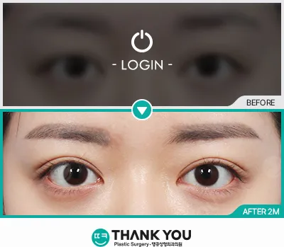 Before/After