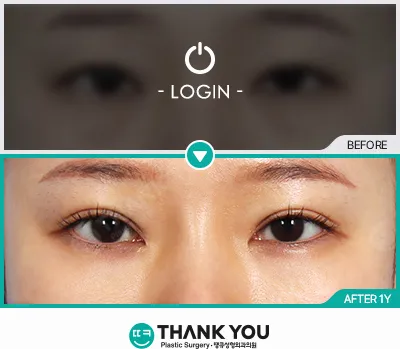 Before/After
