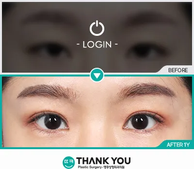 Before/After