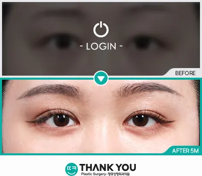Before/After