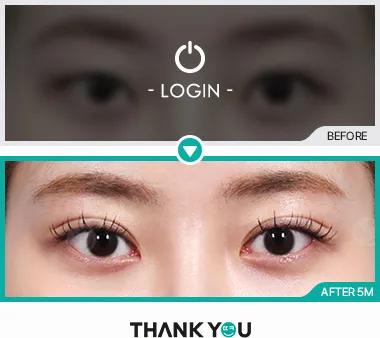 Before/After