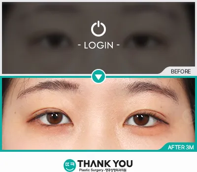 Before/After