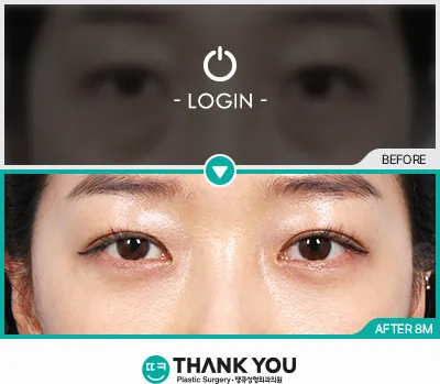 Before/After