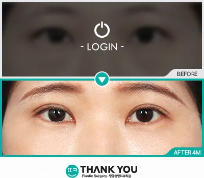 Before/After