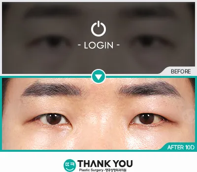 Before/After