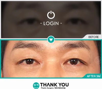 Before/After