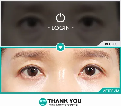 Before/After