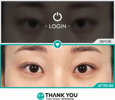 Before/After