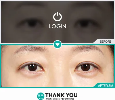 Before/After
