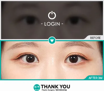 Before/After