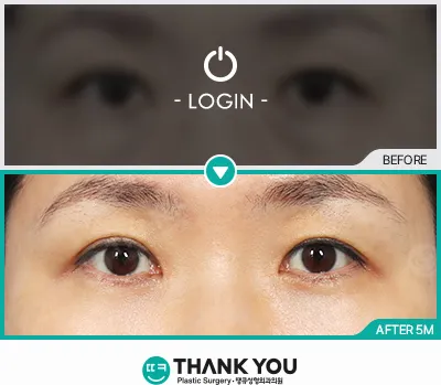 Before/After