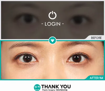Before/After