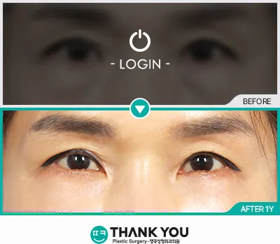 Before/After