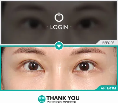Before/After
