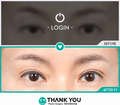 Before/After