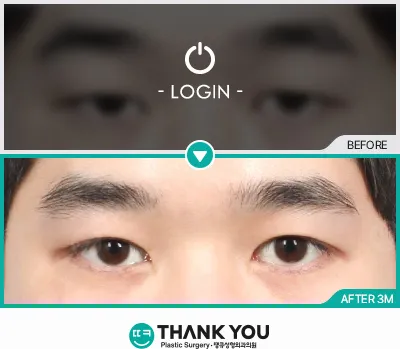 Before/After