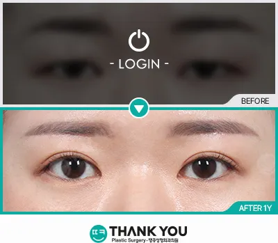 Before/After