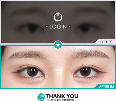 Before/After