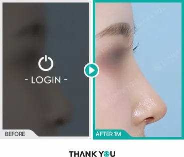Before/After