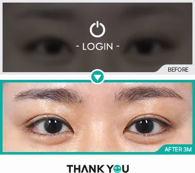 Before/After
