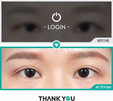 Before/After
