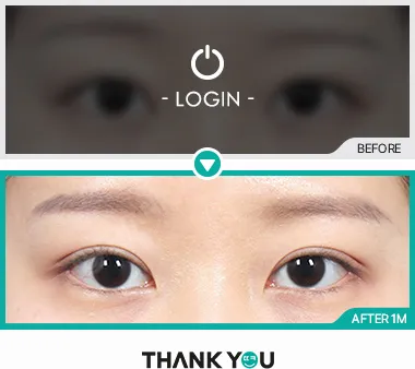 Before/After