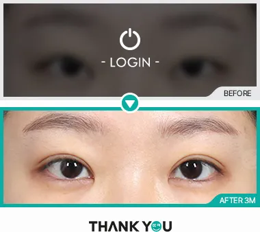 Before/After