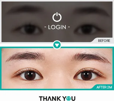 Before/After