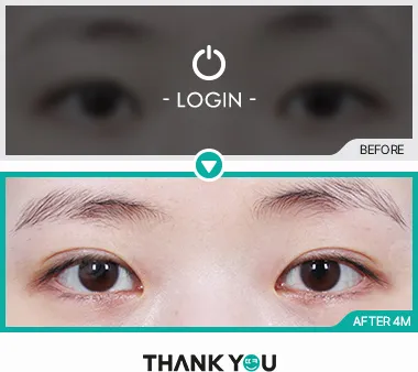 Before/After