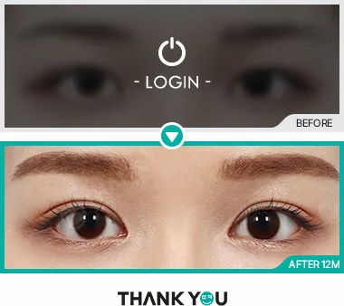 Before/After
